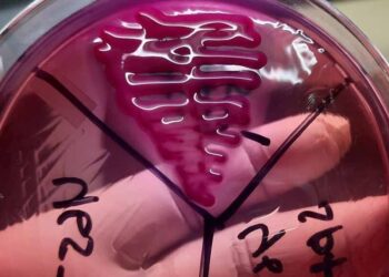 Brote de bacteria en México provoca alarmas entre comunidad de expertos