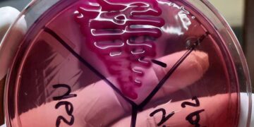 Brote de bacteria en México provoca alarmas entre comunidad de expertos