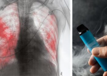 Gobierno de México a través de decreto publicado en el Diario Oficial de la Federación prohíbe el uso de vapeadores