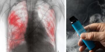 Gobierno de México a través de decreto publicado en el Diario Oficial de la Federación prohíbe el uso de vapeadores