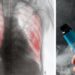 Gobierno de México a través de decreto publicado en el Diario Oficial de la Federación prohíbe el uso de vapeadores
