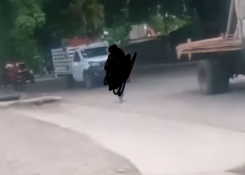 Hombre en Tapachula aparece sin una de sus manos tras una fuerte riña callejera