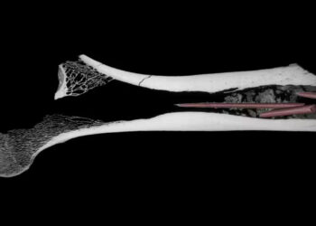 Descubren el veneno en flechas más antiguo del mundo en un hueso de hace 7.000 años