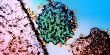 ¿Cuál es el peligro y los síntomas del virus Nipah?